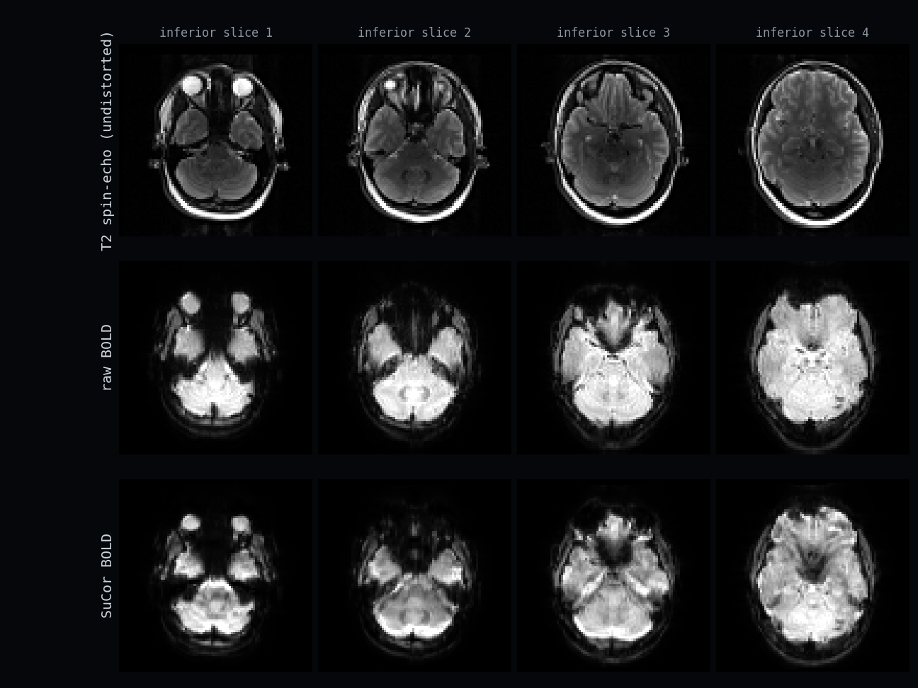 T2 spin-echo vs raw BOLD vs SuCor BOLD across inferior slices